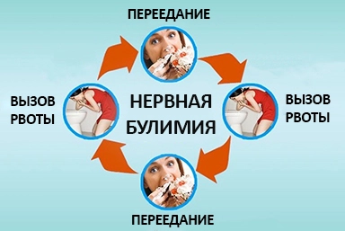 Лечение булимии в Белгороде